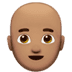 👨🏽‍🦲 man: medium skin tone, bald display on Apple